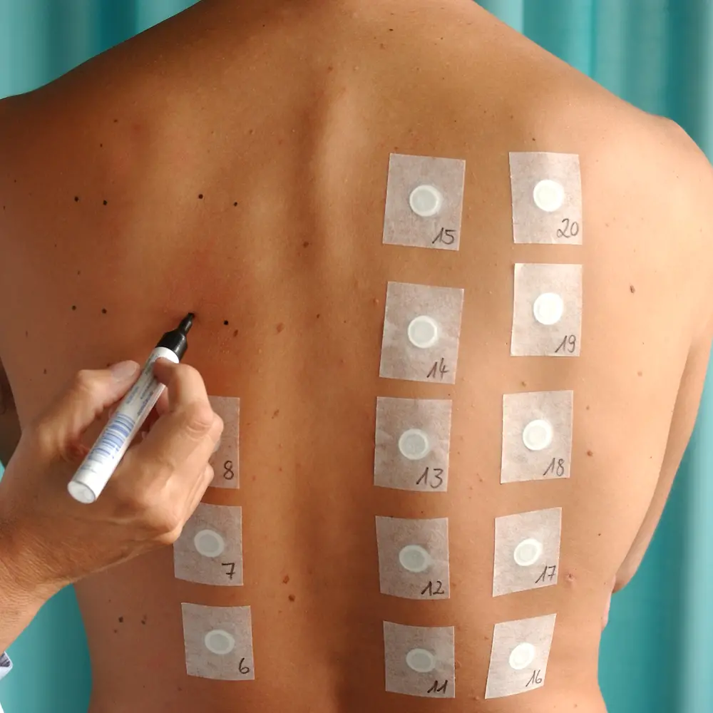 피부 적합성 테스트